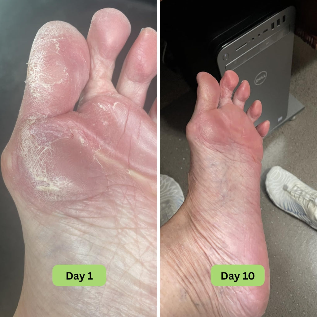 Vanuca™ Tea Tree Oil Antifungal Soap Bar