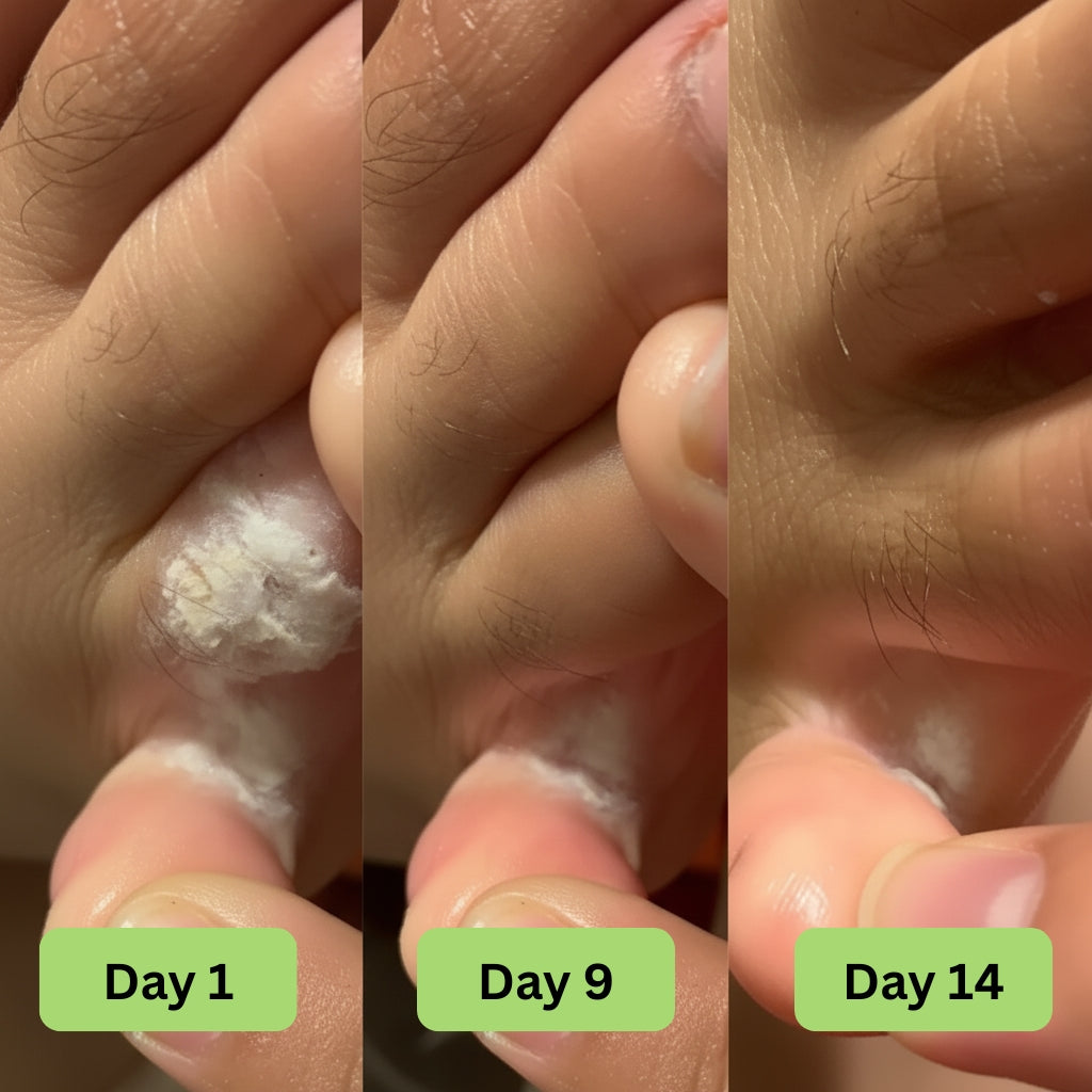 Vanuca™ Tea Tree Oil Antifungal Soap Bar